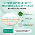  SOMEBYMI 30 days Miracle Micro Pin Spot Patches