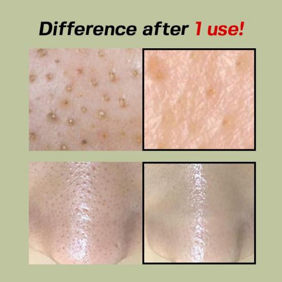 Sungboon Editor Green Tomato Pore Peeling Jumbo Pad 60 бр.