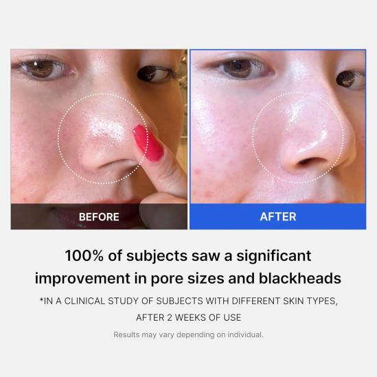 MediCube Zero Pore Pad 2.0 (70pcs)