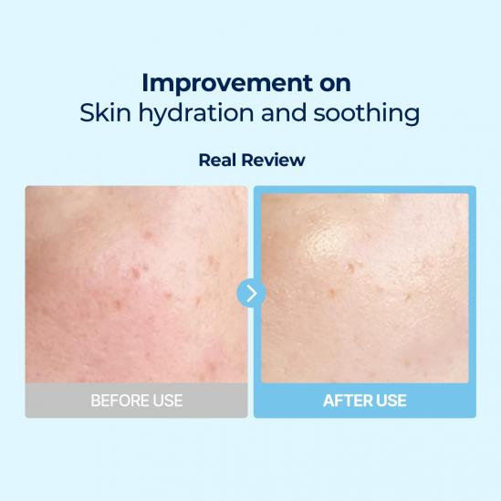 Torriden DIVE-IN Low Molecular Hyaluronic Acid Multi Pad 80ea 