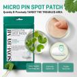  SOMEBYMI 30 days Miracle Micro Pin Spot Patches