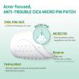  SOMEBYMI 30 days Miracle Micro Pin Spot Patches