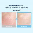Torriden DIVE-IN Low Molecular Hyaluronic Acid Multi Pad 80ea 
